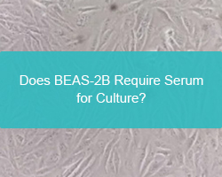 Does BEAS-2B Require Serum for Culture?