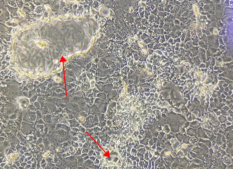 Caco-2 Cell Growth Essentials: Traits and Troubleshooting Tips-2