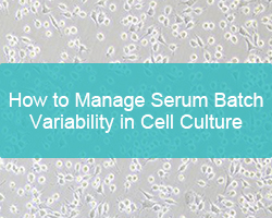How to Manage Serum Batch Variability in Cell Culture